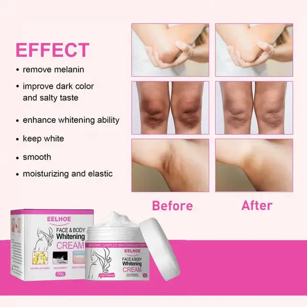 EELHOE Whitening Cream for Private Areas - Intimate Cream - 7 Days Result